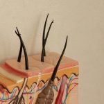 Comment déboucher une glande de meibomius bouchée ?