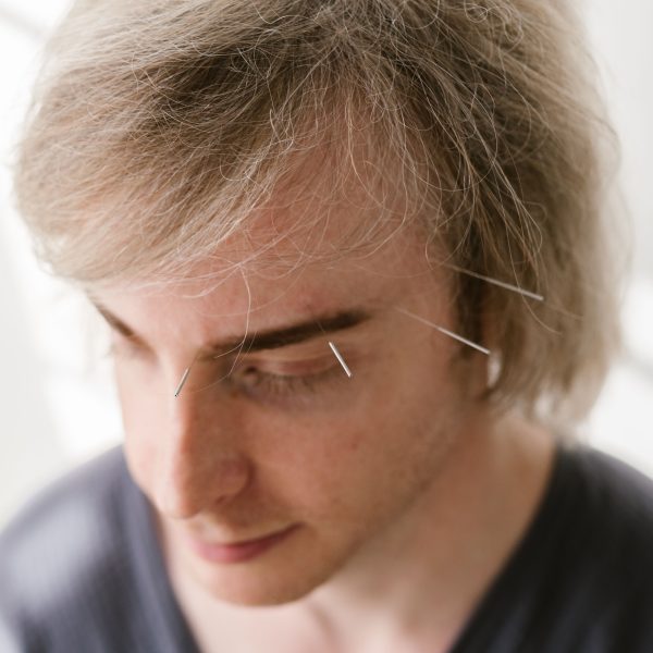 Homme recevant traitement acupuncture visage bien-etre